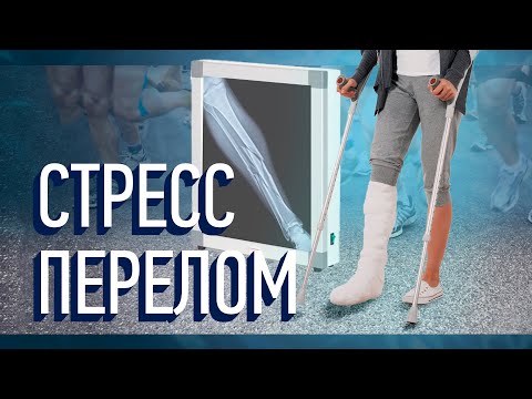 Видео: Стресс перелом. Травмы не было, но она есть!