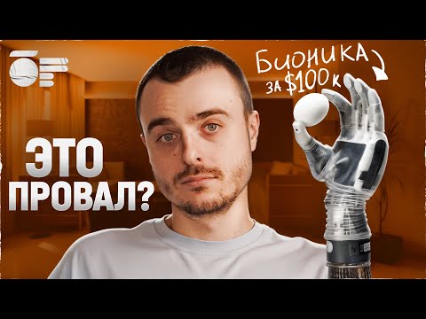 Видео: Самый дорогой протез руки в мире. Что с ним не так?