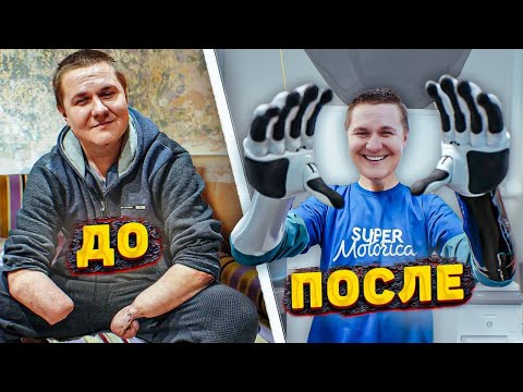 Видео: ДО СЛЁЗ! НОВЫЕ РУКИ ДЛЯ САШИ! НЕВЕРОЯТНЫЙ ФИНАЛ В ЖИЗНИ БЕЗРУКОГО ПАРНЯ