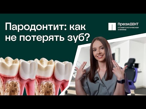 Видео: 🔬 Пародонтит – причины, лечение и профилактика, рассказывает стоматолог - пародонтолог.