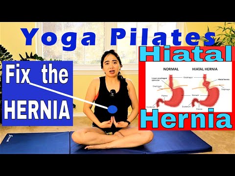 Видео: Выпячивание в верхней части живота? Как исправить грыжу пищеводного отверстия диафрагмы? Легкая и...