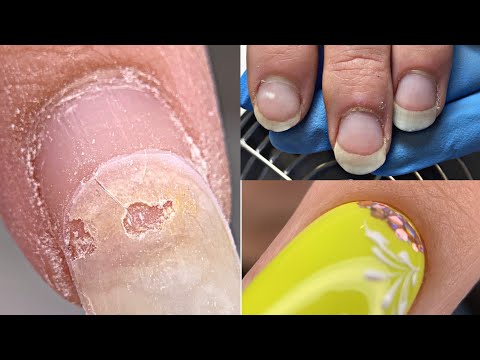 Видео: Пропилила ДЫРУ😱Наращивание💅Неоновый Френч💅Укрепление гелем
