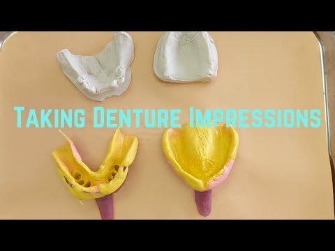 Видео: Снятие слепков зубных протезов