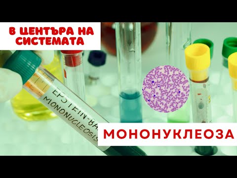 Видео: Мононуклеоза | В центъра на системата