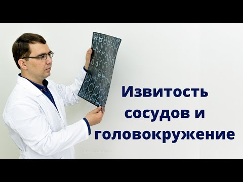 Видео: Извитость сосудов и головокружение