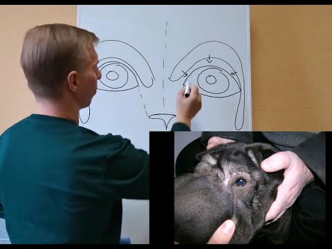 Видео: Выпуск 2. Пластика век  / Issue 2. Plastic surgery of the eyelids