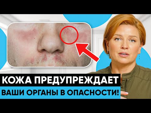Видео: ВЫ ДОЛЖНЫ ЭТО ЗНАТЬ! Кожа указывает на проблемы внутри!