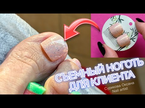 Видео: Педикюр с зачисткой гематомы. Пустота под ногтем, онихолизис. Обработка аппаратом и шлифовка стопы
