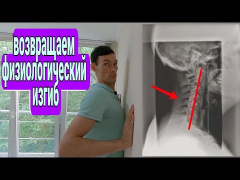Видео: ЧЕМ ОПАСЕН СГЛАЖЕННЫЙ ШЕЙНЫЙ ЛОРДОЗ . упражнения lordosis exercise