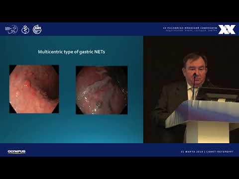 Видео: Нейроэндокринные опухоли ЖКТ
