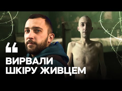 Видео: «На всю спину шрам, забивали до смерті», — прикордонник, якого взяла у полон російська ДРГ