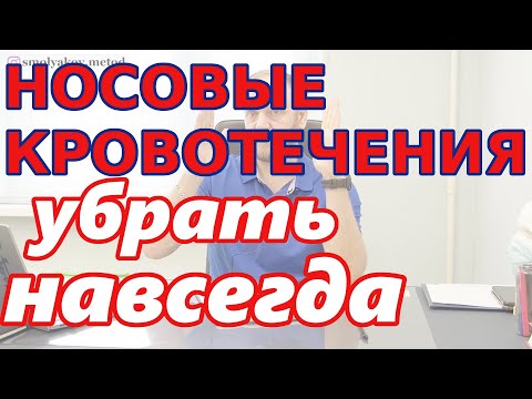 Видео: Как лечить носовые кровотечения (причины и лечение)
