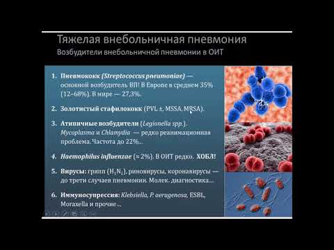 Видео: Внебольничная пневмония - обновленная