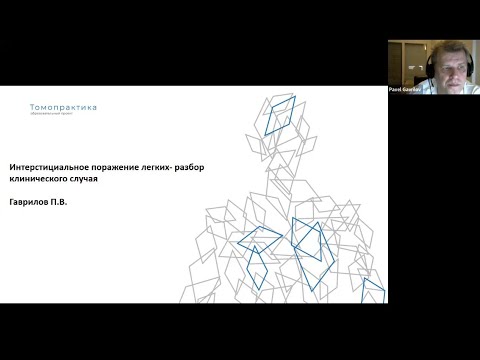 Видео: Интерстициальное поражение легких  разбор клинического случая