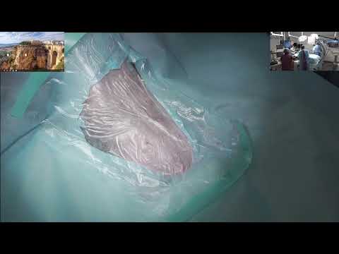 Видео: Шунт внутри печени у овчарки