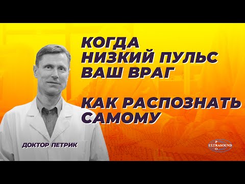 Видео: Когда низкий пульс ваш враг. Как распознать самому.