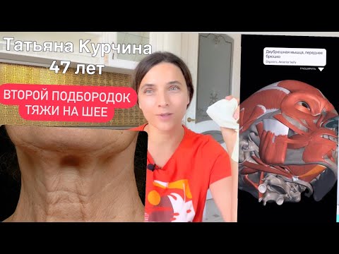 Видео: Второй подбородок и тяжи на шее