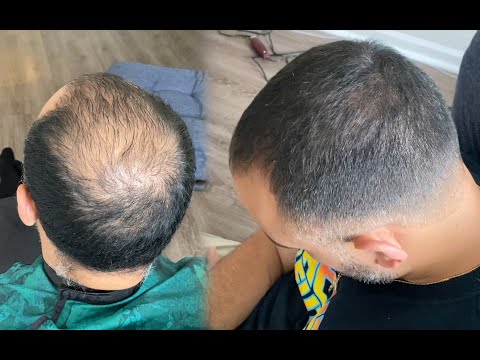 Видео: Масштабное преображение | Как сделать волосы лысеющими и нанести волокна волос