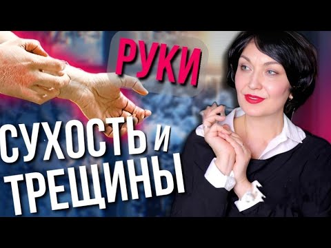 Видео: Сухая кожа рук Зимой. Что делать в домашних условиях? Простые рецепты.
