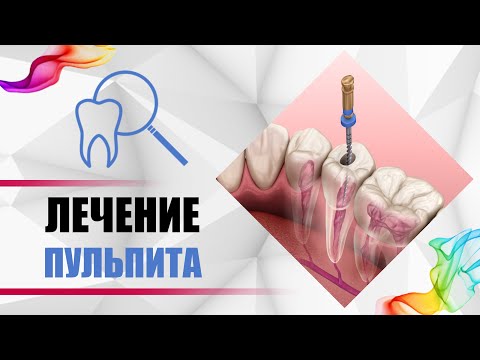 Видео: Пульпит - лечение каналов зуба за 5 шагов! [ Диагностика, симптомы, последствия ].