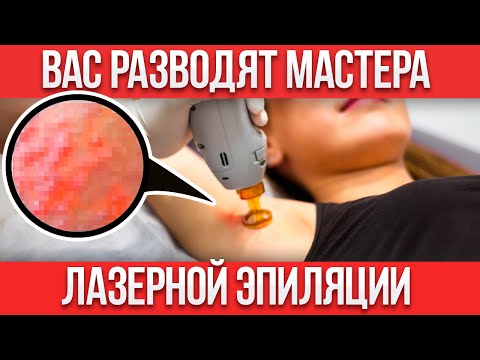 Видео: КОСМЕТОЛОГИ ВАС ОБМАНЫВАЮТ! / Как НАДУВАЮТ на лазерной эпиляции?