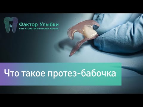 Видео: Что такое протез - бабочка? Когда используют данный съемный протез?