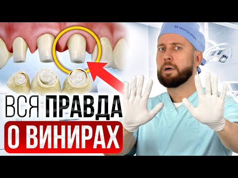 Видео: Что нужно делать перед установкой виниров? Все этапы подготовки!