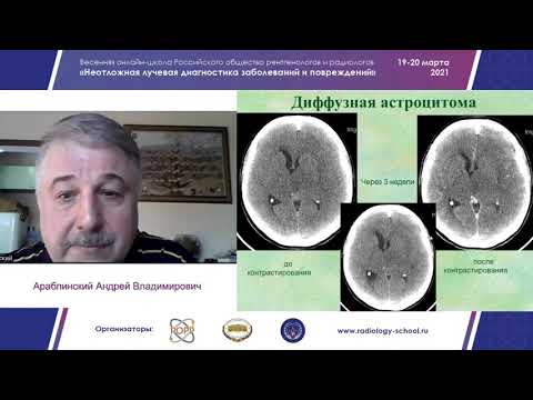 Видео: Дифференциальная диагностика нарушений мозгового кровообращения с помощью КТ и МРТ