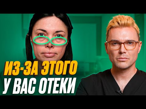 Видео: ВОТ откуда они берутся МЕШКИ и ОТЁКИ под глазами! Всего одно УПРАЖНЕНИЕ ИЗБАВИТ вас от ЭТОГО!