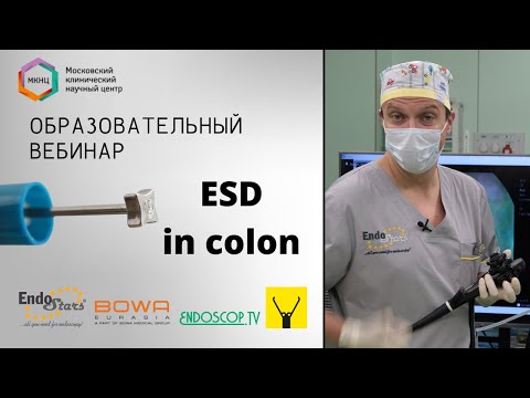Видео: Запись трансляции из МКНЦ 15.06. Клинический случай №6: ESD