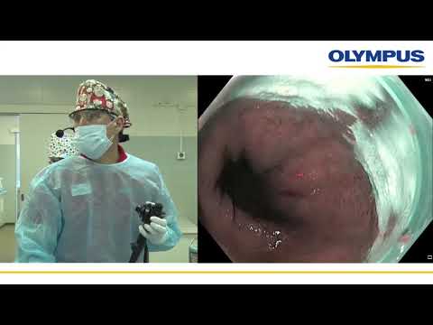 Видео: Диагностика верхних отделов ЖКТ с применением современных технологий. С. В. Кашин