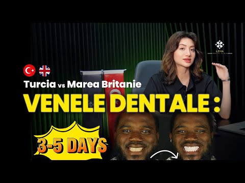 Видео: 🤍 (с субтитрами) Виниры: Турция против Великобритании | Стоматологическая клиника Lema