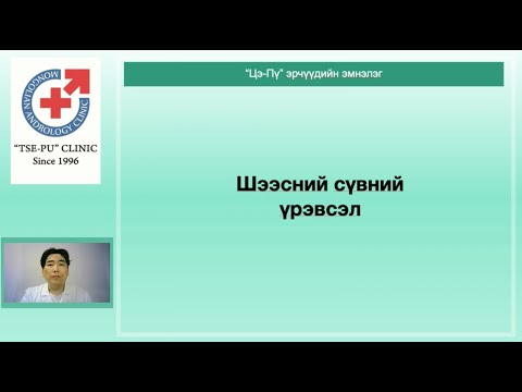 Видео: Шээсний сүвний үрэвсэл