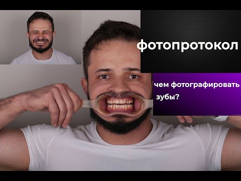 Видео: ЧЕМ ФОТОГРАФИРОВАТЬ ЗУБЫ