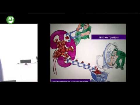 Видео: Дутов С В - Перкутанная нефроскопия и удаление камней. Осложнения ПНЛ