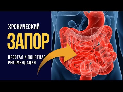 Видео: Узнайте как избавиться от функционального ЗАПОРА за 8 шагов!