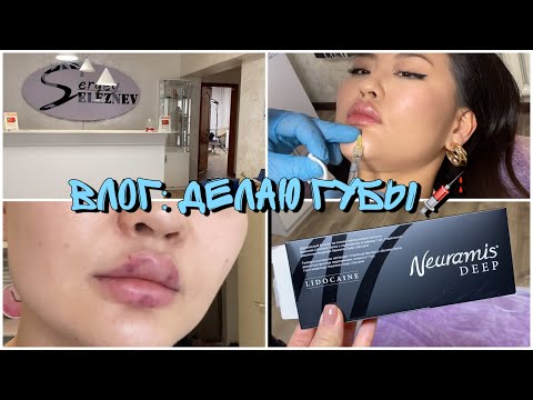 Видео: VLOG: СДЕЛАЛА ГУБЫ, МОЙ ОПЫТ