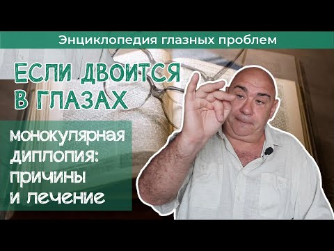 Видео: Почему двоится в глазах. Монокулярная диплопия.