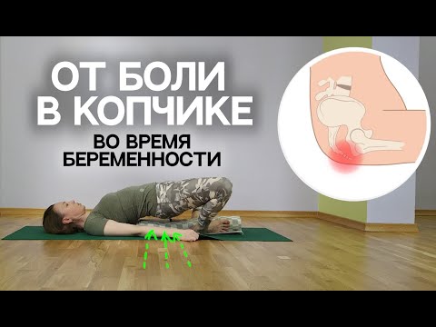 Видео: Боль в копчике при беременности