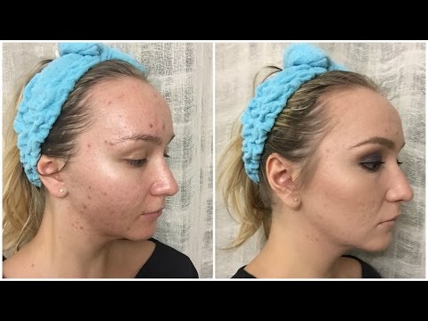 Видео: Макияж для проблемной кожи - Estee Lauder Double Wear / Makeup for Acne