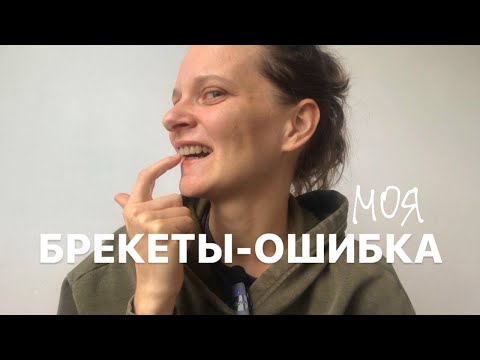 Видео: Я поставила брекеты и это оказалось ошибкой