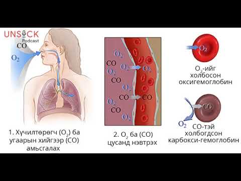 Видео: Unsick podcast #12: Угаарын хий хүний биед хэрхэн хордлого үүсгэдэг вэ?