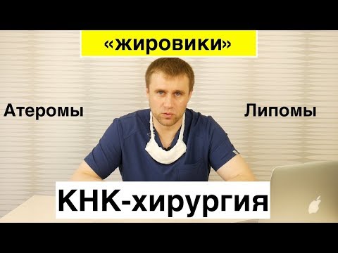 Видео: "Жировики"
