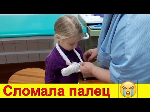 Видео: Vlog ОЛИВКА СЛОМАЛА ПАЛЕЦ / Беженар Life