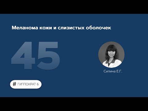 Видео: Меланома кожи и слизистых оболочек. 22.06.23.