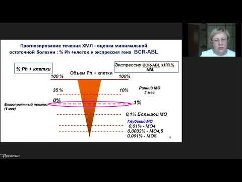 Видео: Хронический миелолейкоз. Наблюдение за пациентами с глубоким молекулярным ответом без терапии.