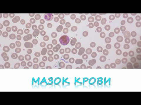 Видео: гистопрепарат МАЗОК КРОВИ
