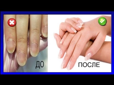 Видео: ИЗБАВИТЕСЬ от КУТИКУЛЫ и ЗАУСЕНЦЕВ простым способом