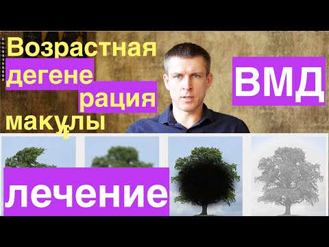 Видео: Возрастная дегенерация макулы или макулодистрофия - как сохранить зрение