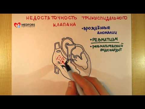 Видео: Недостаточность трёхстворчатого клапана - "Просто о сложном"